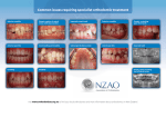 Common issues requiring specialist orthodontic treatment