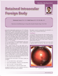 Retained Intraocular Foreign Body