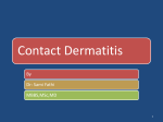 Contact Dermatitis