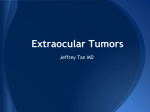 Extraocular Tumors