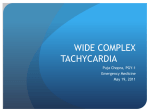 wide complex tachycardia - Calgary Emergency Medicine