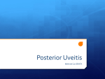 Posterior Uveitis