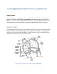 Trans-Septal Puncture Procedures and Devices