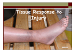 Tissue Response to Injury