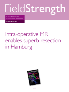 Intra-operative MR enables superb resection in