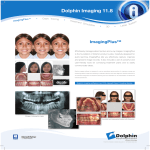 Dolphin Imaging 11.8