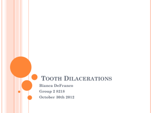 Tooth Dilacerations