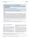 Ductal carcinoma in situ of the breast: morphological and molecular