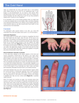 The Cold Hand - American Society for Surgery of the Hand