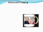 Advanced Ultrasound Imaging