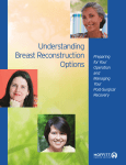 Understanding Breast Reconstruction Options