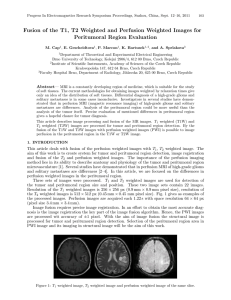 Fusion of the T1, T2 Weighted and Perfusion Weighted Images for