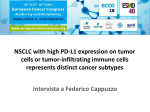 NSCLC with high PD-L1 expression on tumor cells or tumor