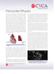 Pericardial Effusion