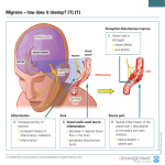 Migraine – how does it develop | CHANGE PAIN