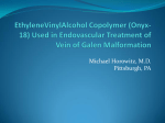 Vein of Galen Malformation Onyx Therapy