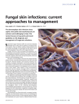 Fungal skin infections: current approaches to management