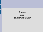 Burns and Skin Pathology