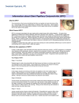 Information about Giant Papillary Conjunctivitis (GPC) Swanson