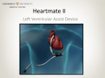 Heartmate II