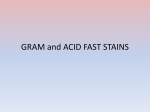 The Acid Fast Stain - IRSC Biology Department