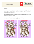 Marfan`s Syndrome