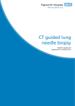 CT guided lung needle biopsy