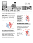 ascending-aorta surgery