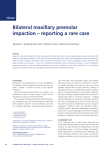 Bilateral maxillary premolar impaction