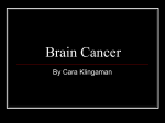 Brain Cancer