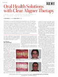 Oral Health Solutions with Clear Aligner Therapy