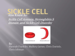 Sickle Cell PPT