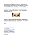 Retinoblastoma is a malignant intraocular tumor that develops from