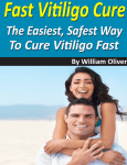 to Fast Vitiligo Cure