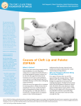 Causes of Cleft Lip and Palate: ZOFRAN