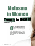 Melasma in Women