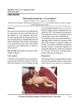 Phocomelia Syndrome - A Case Report