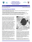 Radiology Rounds - July 2004 - Evaluating Pulmonary Nodules
