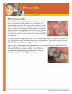 Pericoronitis - Cfdonline.Com