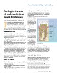 Getting to the root of endodontic (root canal) treatments