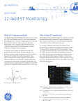 12-lead ST Monitoring - Clinical View