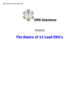 The Basics of 12 Lead EKG`s