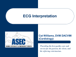 ECG Interpretation