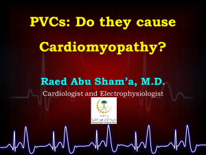 PVCs - Saudi Heart Association