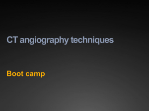 CT angiography techniques