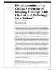 Pseudomembranous Colitis: Spectrum of Imaging Findings with