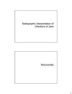 Radiographic Interpretation of Infections of Jaws Pericoronitis