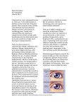 Maria De Shazer Pre-optometry Class of 2013 Conjunctivitis