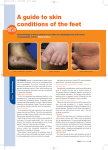 A guide to skin conditions of the feet