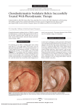 Chondrodermatitis Nodularis Helicis Successfully